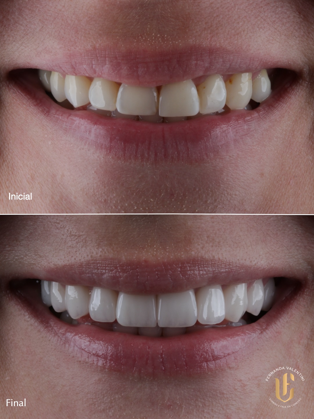 Transformação Scop Face