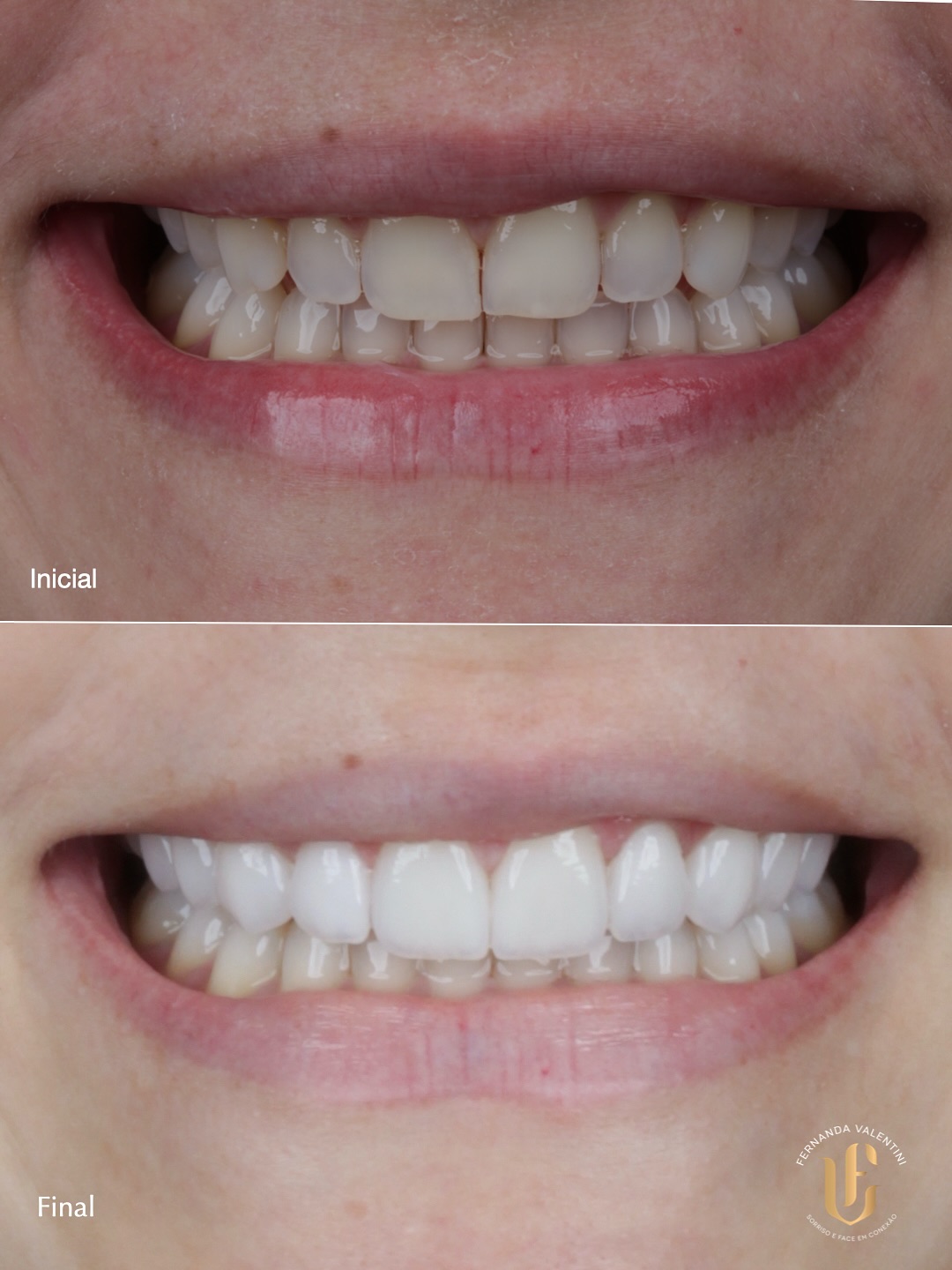 Transformação Scop Face