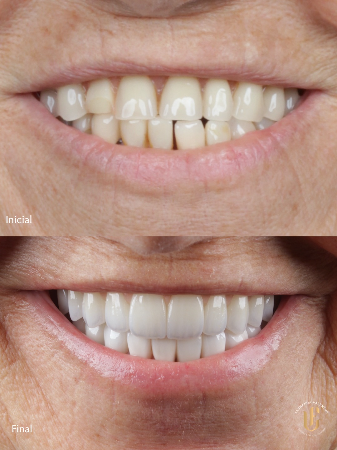 Transformação Scop Face