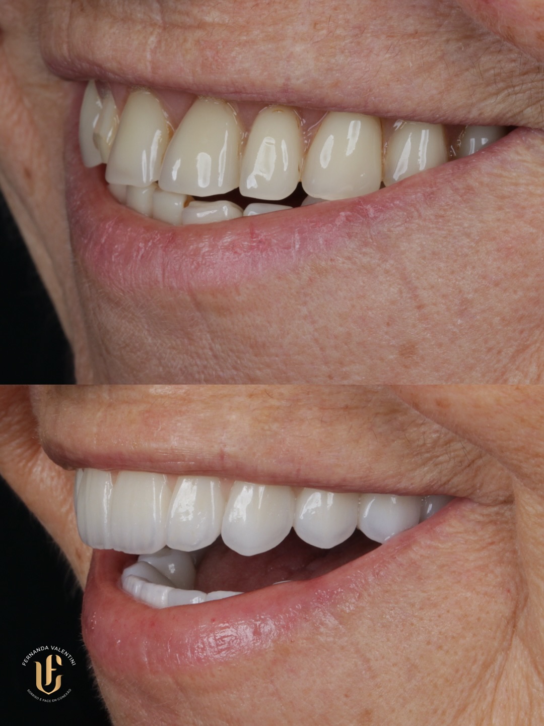 Transformação Scop Face