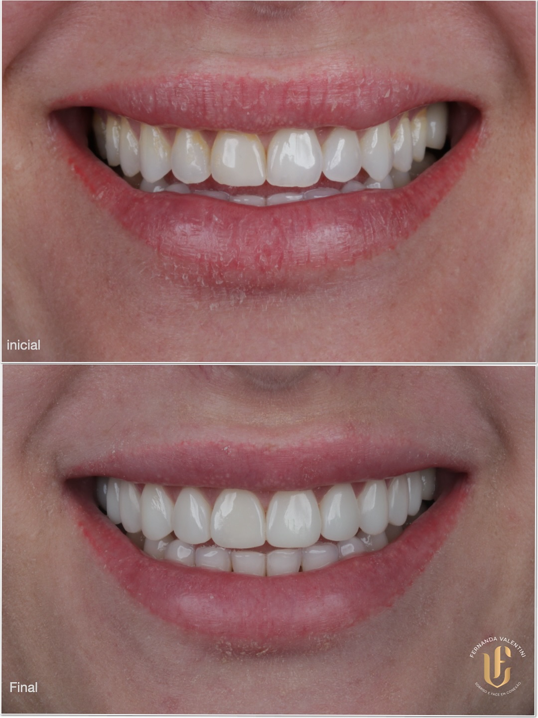 Transformação Scop Face