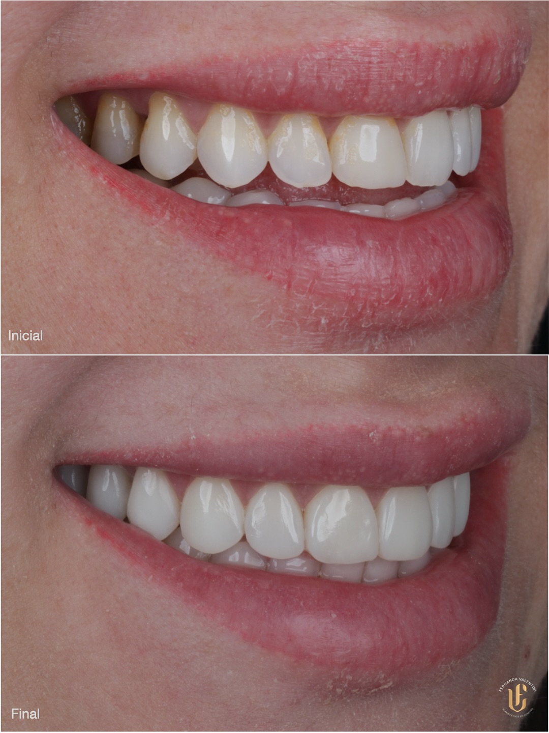 Transformação Scop Face